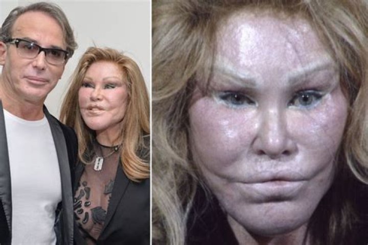 Bride of Wildenstein arrested after 'slashing boyfriend with scissors
