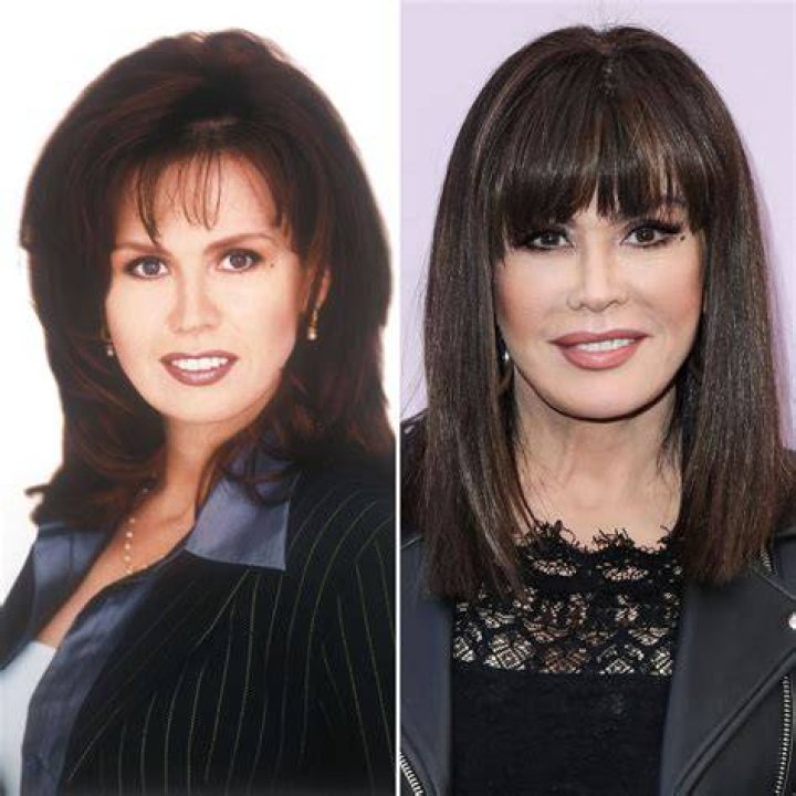Did Marie Osmond Get Plastic Surgery? Transformation Photos