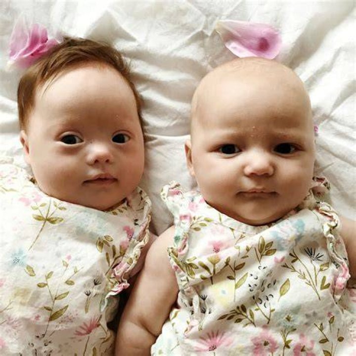 Down&rsquo;s Syndrome Twins Are One In A Million YouTube