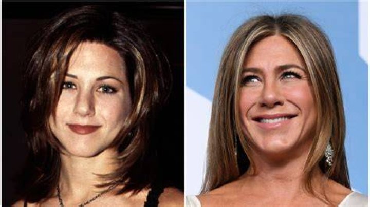 Has Jennifer Aniston Had Plastic Surgery? Comments, Procedures, More