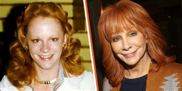 Has Reba McEntire Had Plastic Surgery? A Specialist in the Field Weighs In
