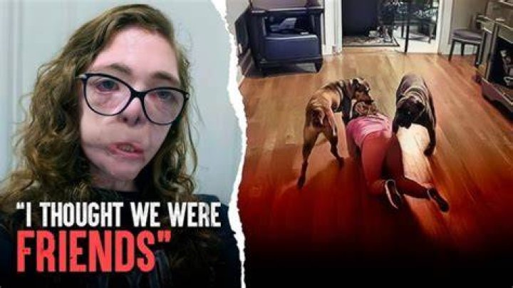 Jacqueline Durand Dog Attack Video 22 Years Old Texas Student Shares