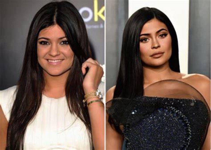 kylie jenner before and after Recherche Google Peinados fáciles para cabello corto, Labios