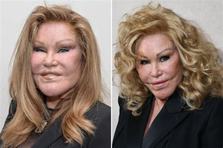 &lsquo;Catwoman&rsquo; Jocelyn Wildenstein Says She&rsquo;s Never Had Plastic Surgery