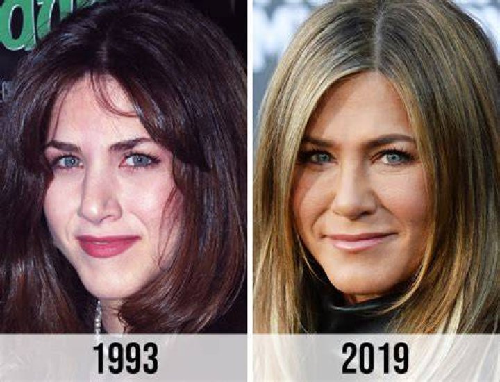 Nicole Aniston Before Plastic Surgery celebrity plastic surgery