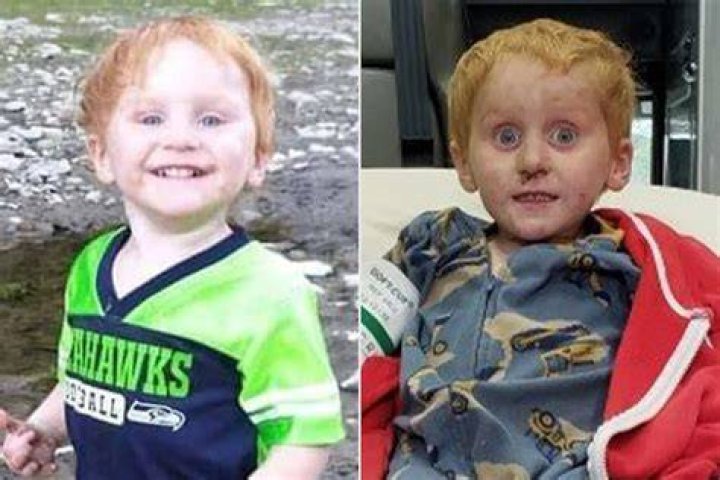 Ryker Webb Before And After Photos