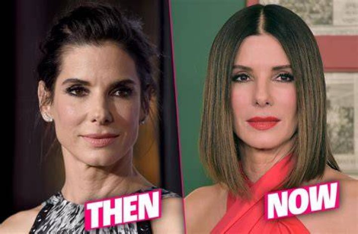 Sandra Bullock Plastic Surgery Speculations Sparked By Oscar Appearance