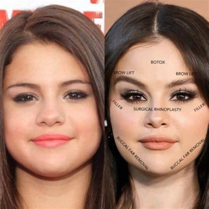 Unveiling The Truth Behind Selena Gomez's Pregnancy Rumors: Uncovering The Mystery