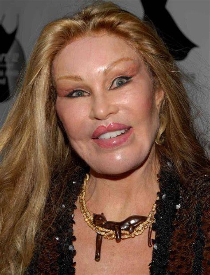 Who is Jocelyn Wildenstein, what's her net worth, what did she look